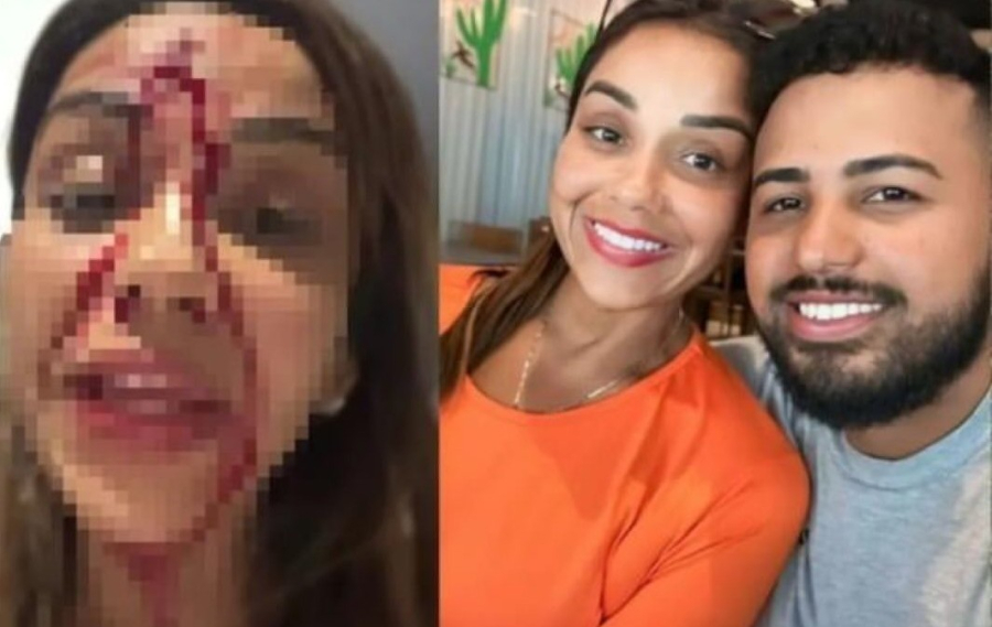 Walkiria Estarley, ex-Farra da Gordinha, usa redes sociais para denunciar agressão por parte do ex em Teresina