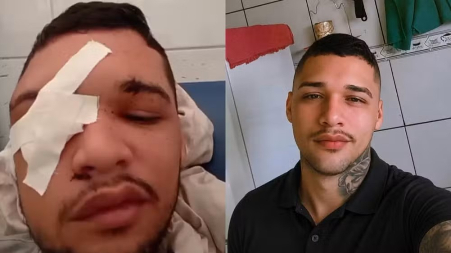 Jovem baleado duas vezes na cabeça afirma ter sido confundido com parente; polícia investiga